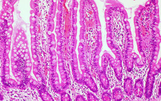 All disease begins in the (leaky) gut