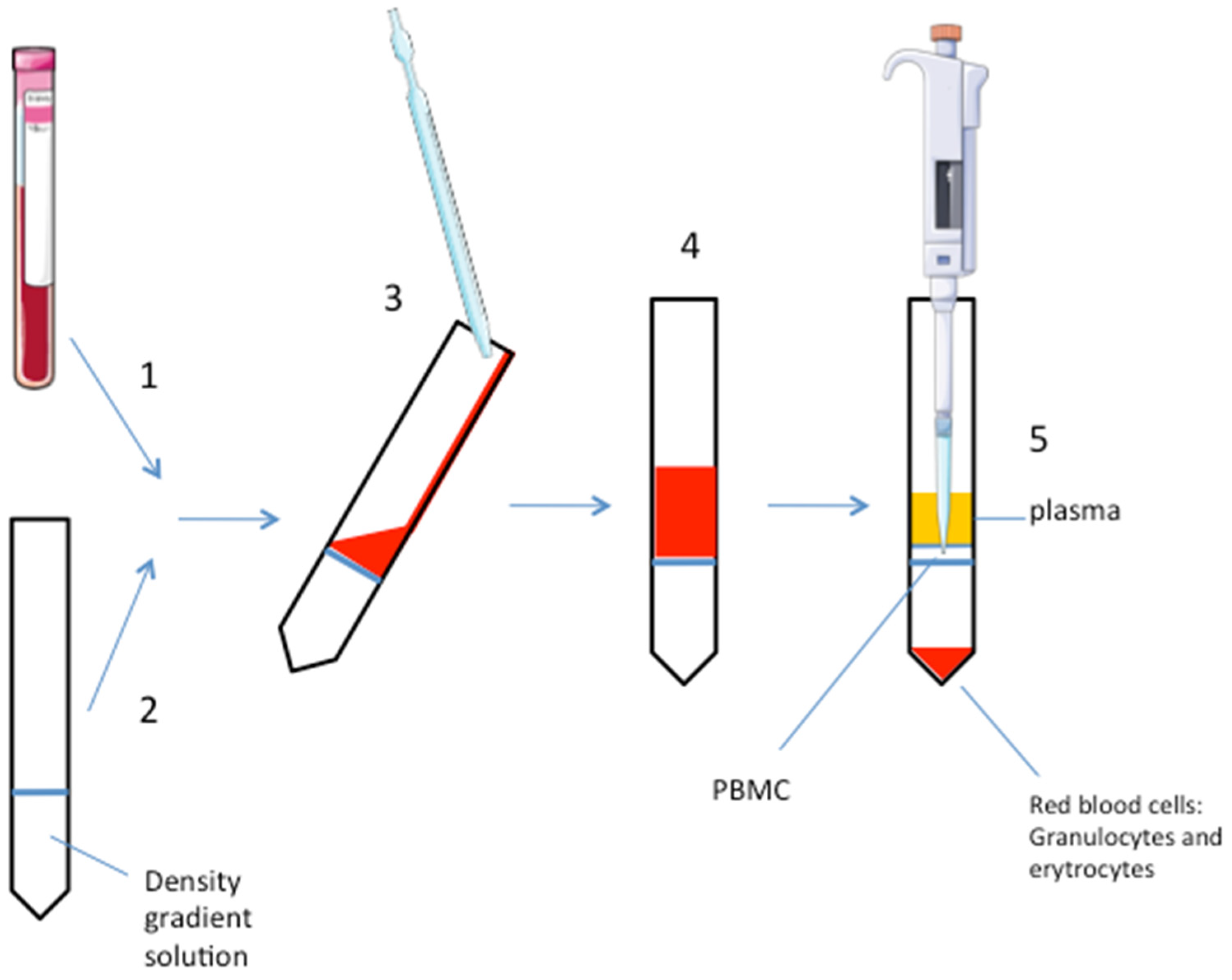 Optimization of Peripheral Blood Mononuclear Cell Extraction from Small Volume of Blood Samples: Potential Implications for Children-Related Diseases